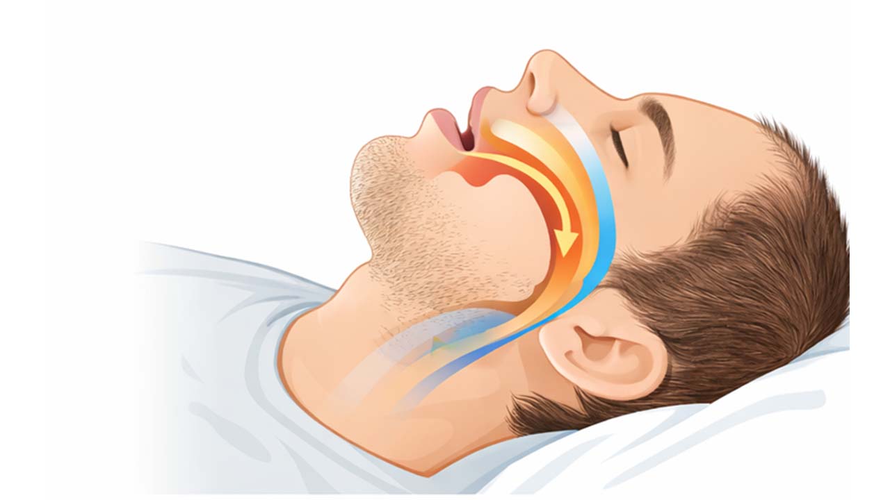 Γιατί Ροχαλίζουμε; Οι Πιο Συχνές Αιτίες