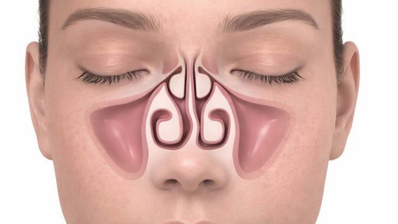 Κογχοπλαστική σε Υπερτροφικές Ρινικές Κόγχες: Σύγχρονη Αντιμετώπιση της Ρινικής Απόφραξης